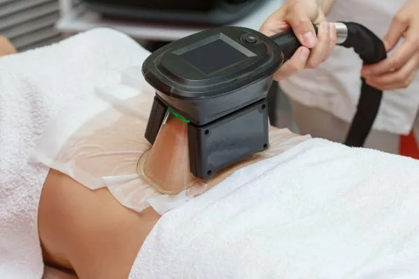 Image of person having fat freezing treatment to help weight gain Thetford