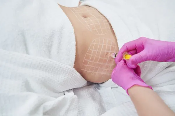image of fat dissolving injections on love handles to help combat weight gain Thetford