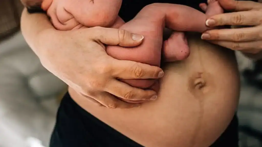 Why Is My Stomach Still Big After Pregnancy Thetford?